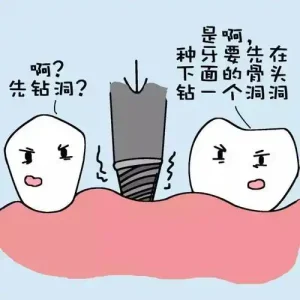 种植牙是不是智商税？有什么坏处？