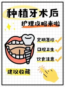 种植牙术后护理指南