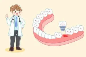 30岁装假牙好还是种植牙好